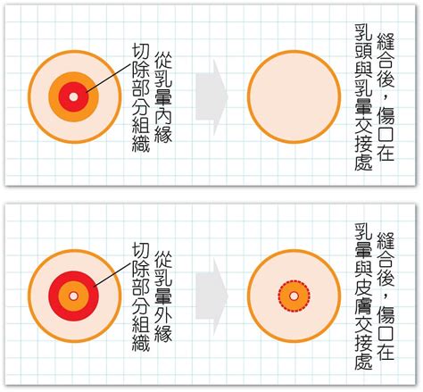 乳暈有毛|乳頭毛